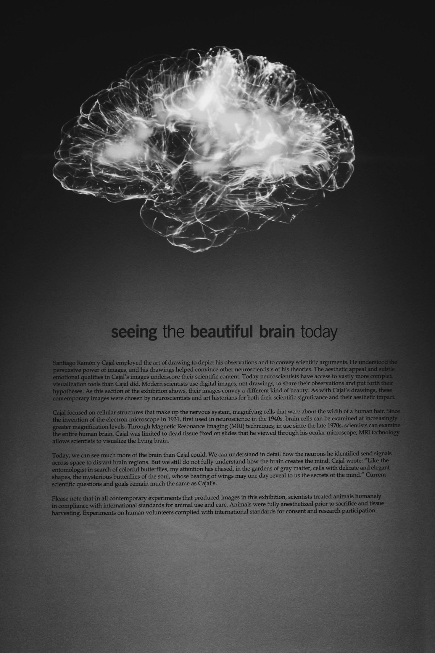 How Sleep Affects Brain Function and Health